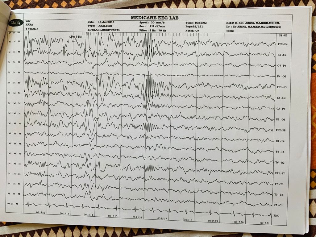 Patient Story